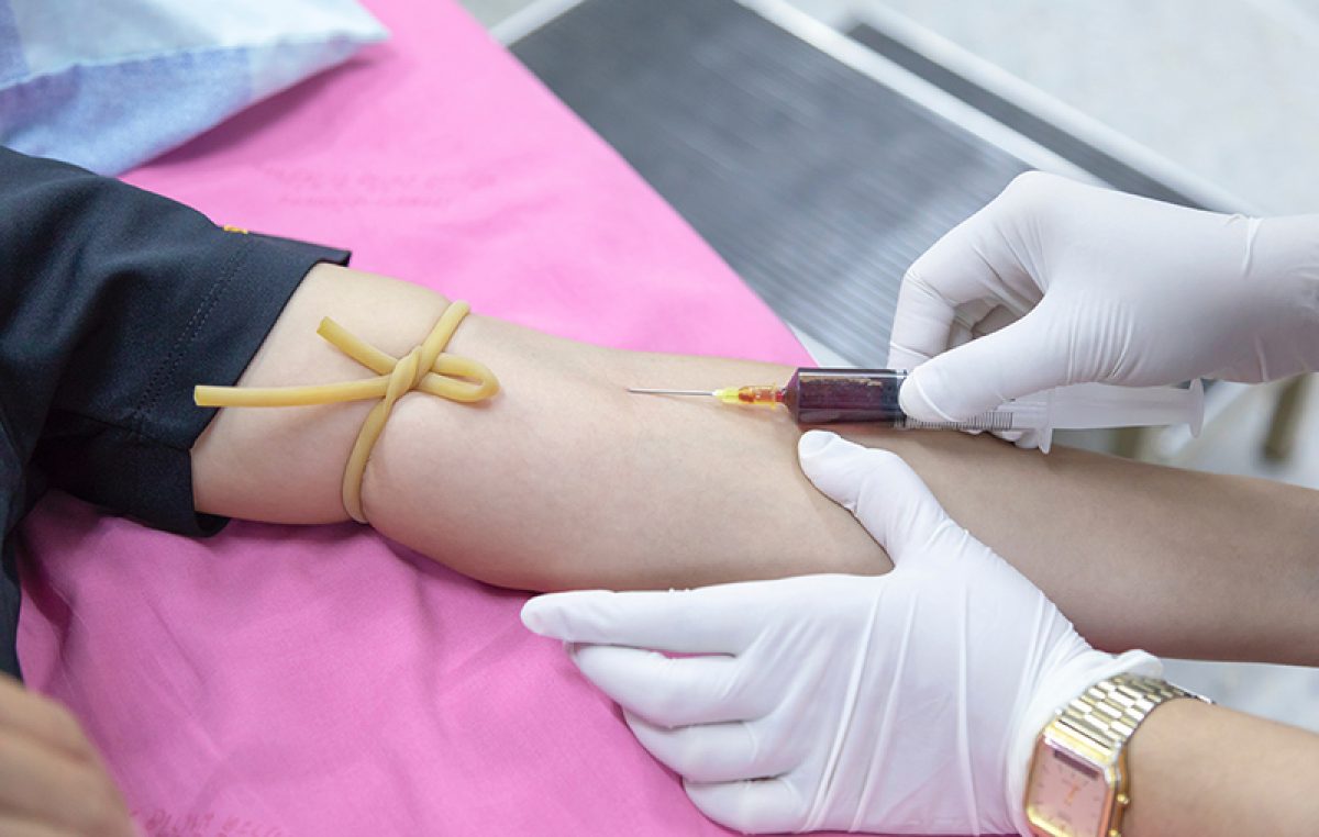 Akcija dobrovoljnog darivanja krvi sutra u Lovranu